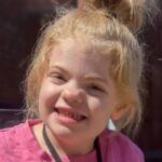 Zobozdravnik brezplačno popravlja zobe revnim ljudem po vsem svetu: “Želimo jim dati nov začetek”